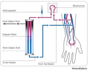 GranuFlo Dialysis Injury Diagram