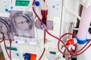 dialysis machine